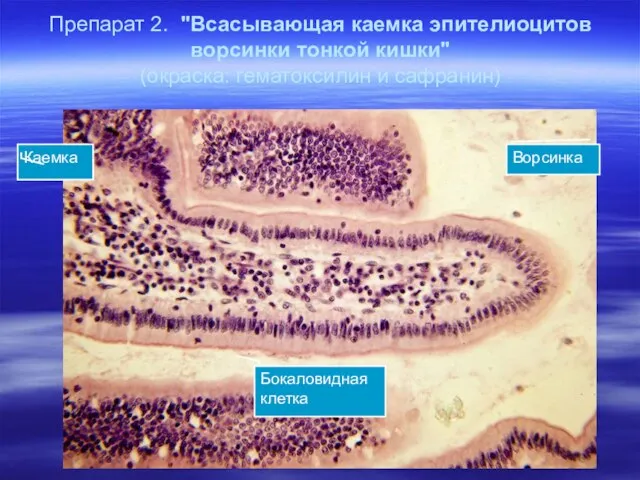 Препарат 2. "Всасывающая каемка эпителиоцитов ворсинки тонкой кишки" (окраска: гематоксилин и сафранин) Ворсинка Бокаловидная клетка Каемка