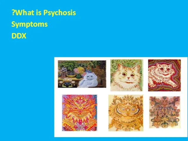 מבנה ההרצאה What is Psychosis? Symptoms DDX