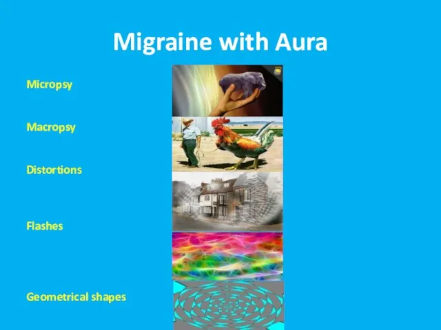 Migraine with Aura Micropsy Macropsy Distortions Flashes Geometrical shapes