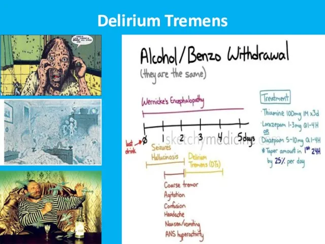 Delirium Tremens