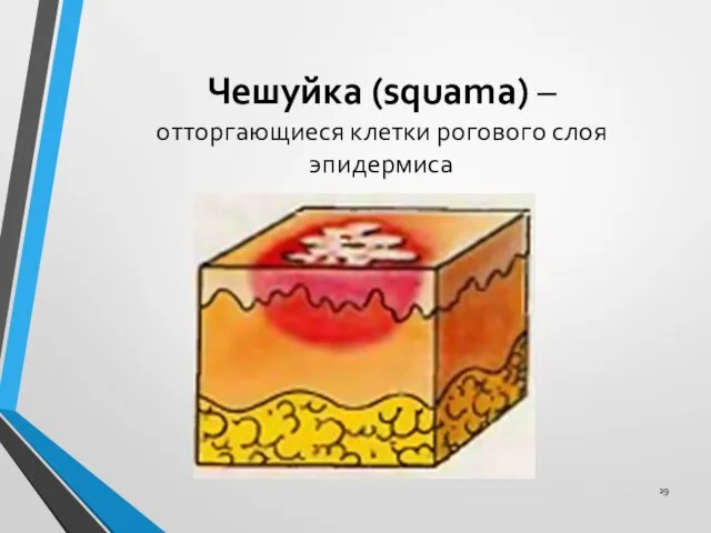 Чешуйка (squama) – отторгающиеся клетки рогового слоя эпидермиса