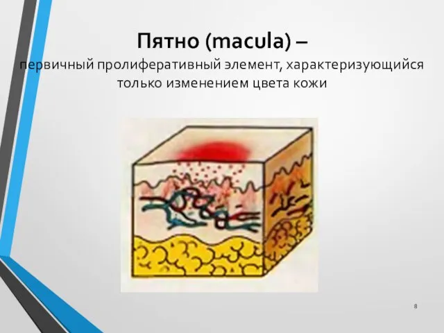 Пятно (macula) – первичный пролиферативный элемент, характеризующийся только изменением цвета кожи