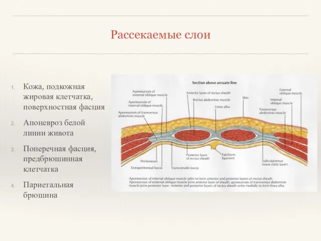 Рассекаемые слои Кожа, подкожная жировая клетчатка, поверхностная фасция Апоневроз белой линии