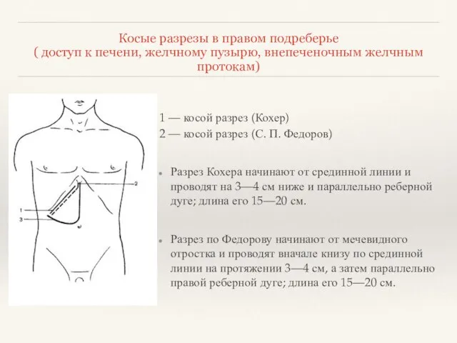 Косые разрезы в правом подреберье ( доступ к печени, желчному пузырю,