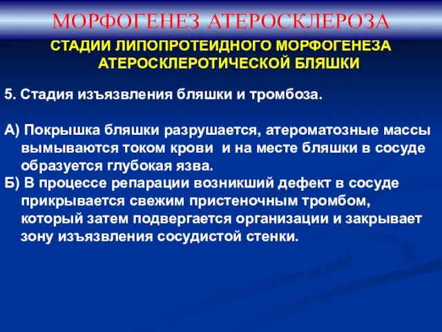 СТАДИИ ЛИПОПРОТЕИДНОГО МОРФОГЕНЕЗА АТЕРОСКЛЕРОТИЧЕСКОЙ БЛЯШКИ 5. Стадия изъязвления бляшки и тромбоза.