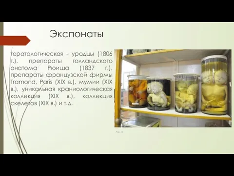 Экспонаты тератологическая - уродцы (1806 г.), препараты голландского анатома Рюиша (1837