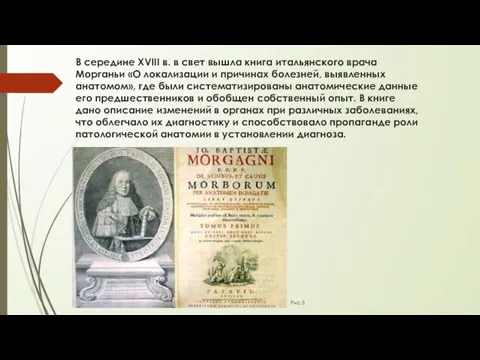 В середине XVIII в. в свет вышла книга итальянского врача Морганьи