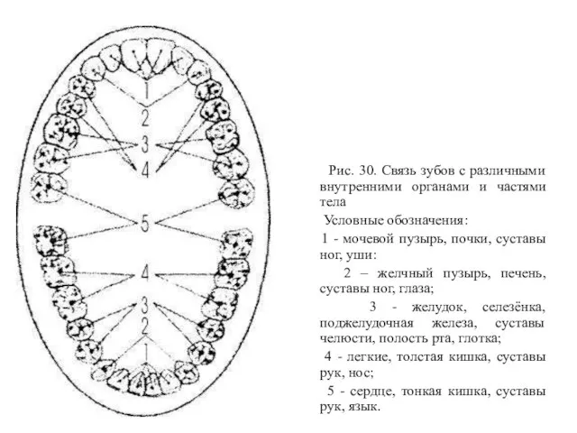 Рис. 30. Связь зубов с различными внутренними органами и частями тела