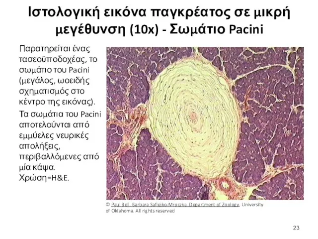 Ιστολογική εικόνα παγκρέατος σε μικρή μεγέθυνση (10x) - Σωμάτιο Pacini Παρατηρείται