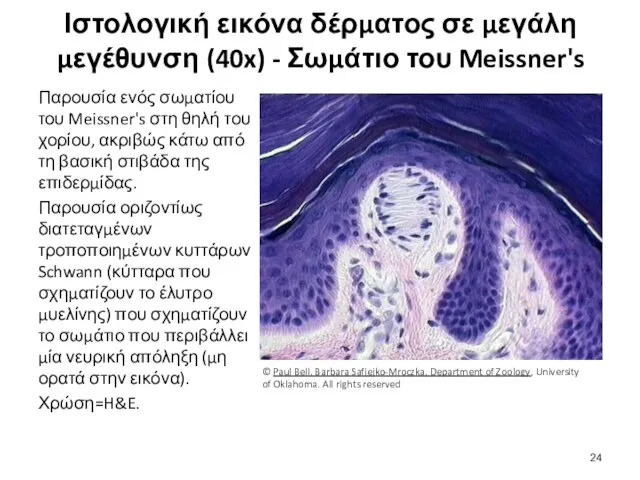 Ιστολογική εικόνα δέρματος σε μεγάλη μεγέθυνση (40x) - Σωμάτιο του Meissner's