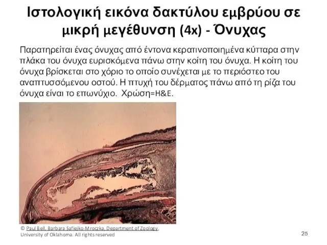 Ιστολογική εικόνα δακτύλου εμβρύου σε μικρή μεγέθυνση (4x) - Όνυχας Παρατηρείται