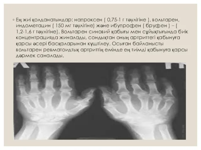 Ең жиі қолданатындар: напроксен ( 0,75-1 г тәулігіне ), вольтарен, индометацин