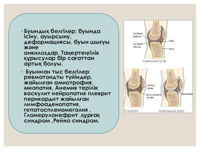 Буындық белгілер: буында ісіну, ауырсыну, деформациясы, буын шығуы және анкилоздар. Таңертеңгілік