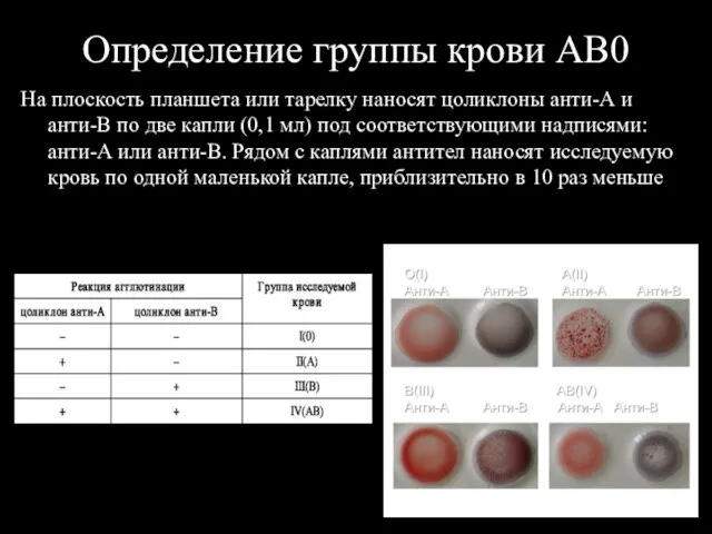 Определение группы крови АВ0 На плоскость планшета или тарелку наносят цоликлоны