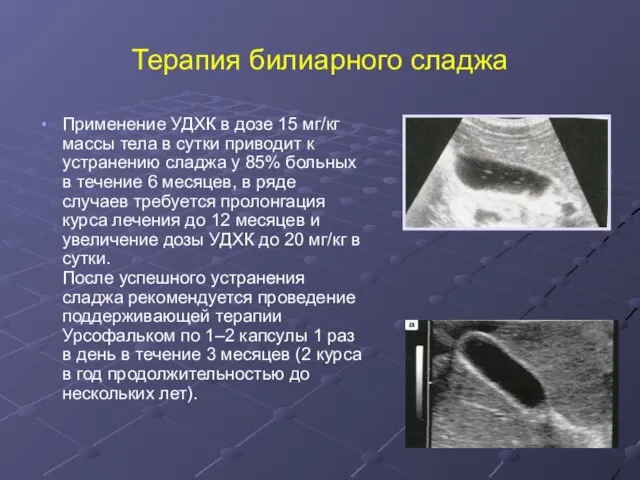 Терапия билиарного сладжа Применение УДХК в дозе 15 мг/кг массы тела