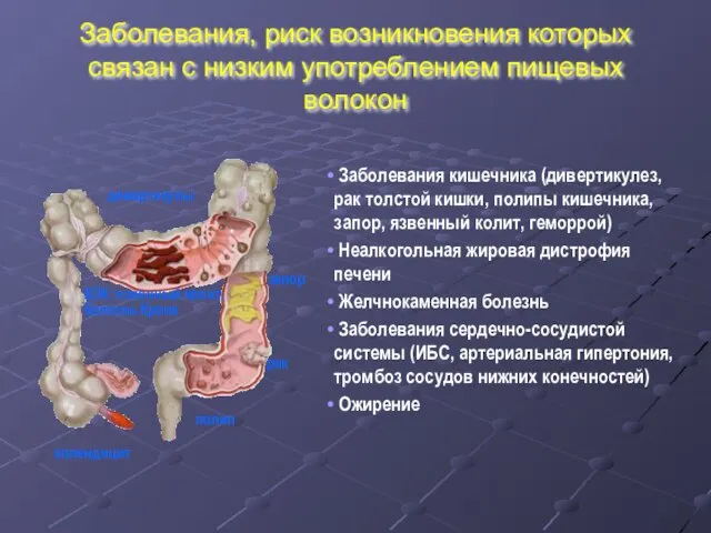 Заболевания, риск возникновения которых связан с низким употреблением пищевых волокон Заболевания