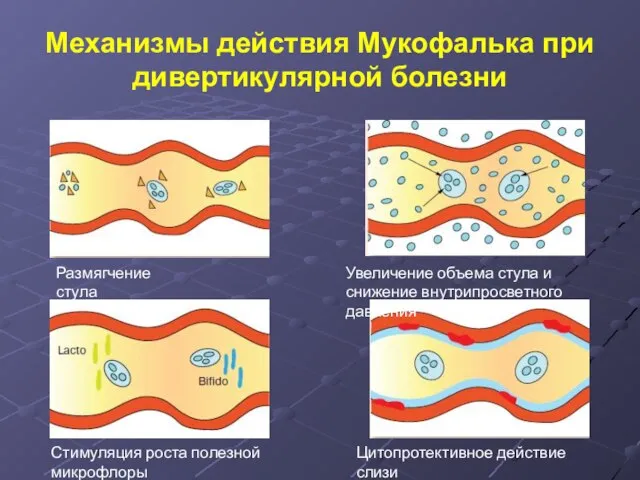 Механизмы действия Мукофалька при дивертикулярной болезни Размягчение стула Цитопротективное действие слизи