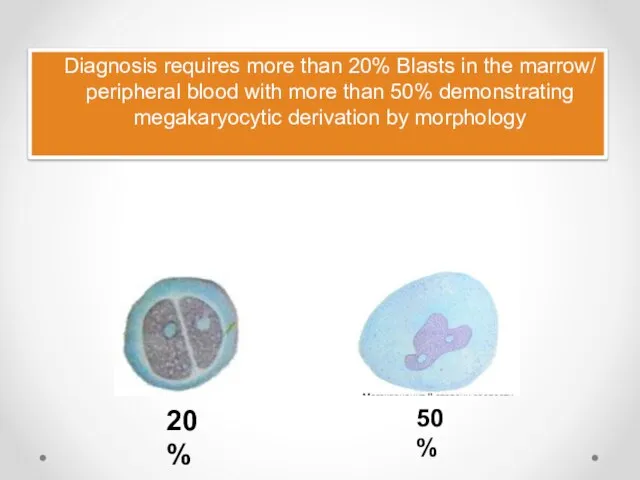 Diagnosis requires more than 20% Blasts in the marrow/ peripheral blood