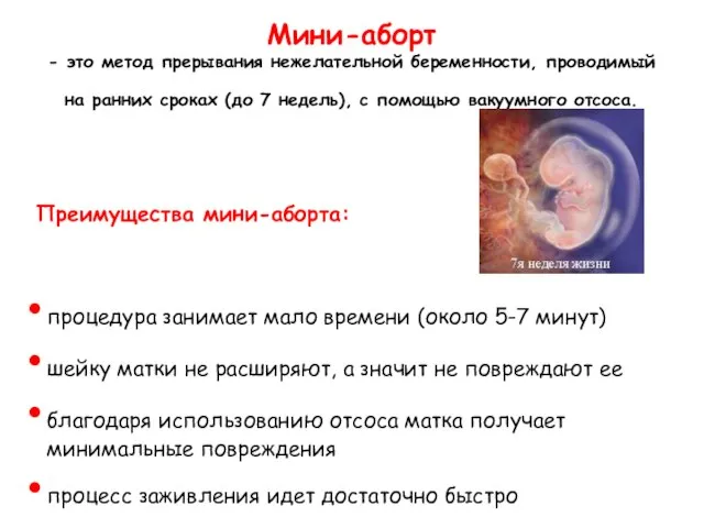 Мини-аборт - это метод прерывания нежелательной беременности, проводимый на ранних сроках