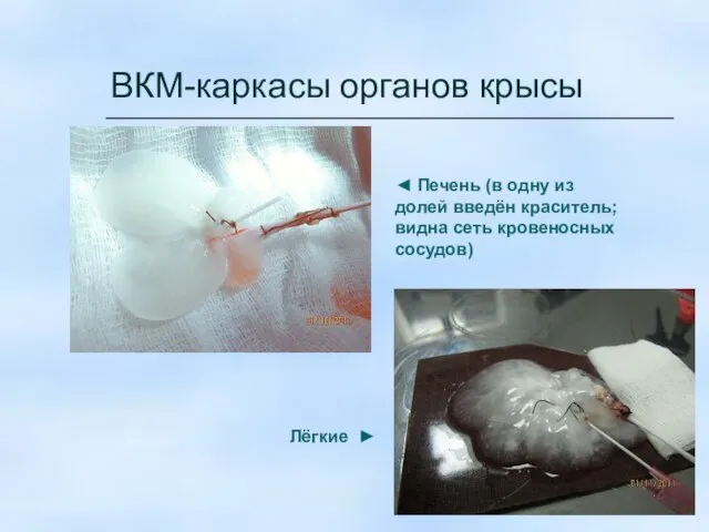 ВКМ-каркасы органов крысы ◄ Печень (в одну из долей введён краситель;