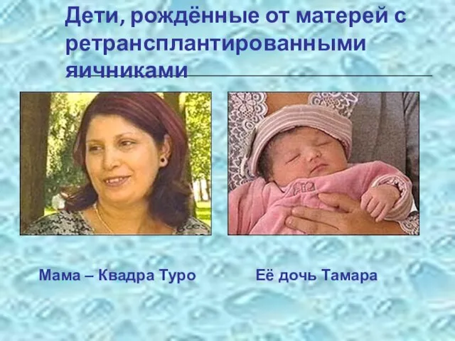 Дети, рождённые от матерей с ретрансплантированными яичниками Мама – Квадра Туро Её дочь Тамара