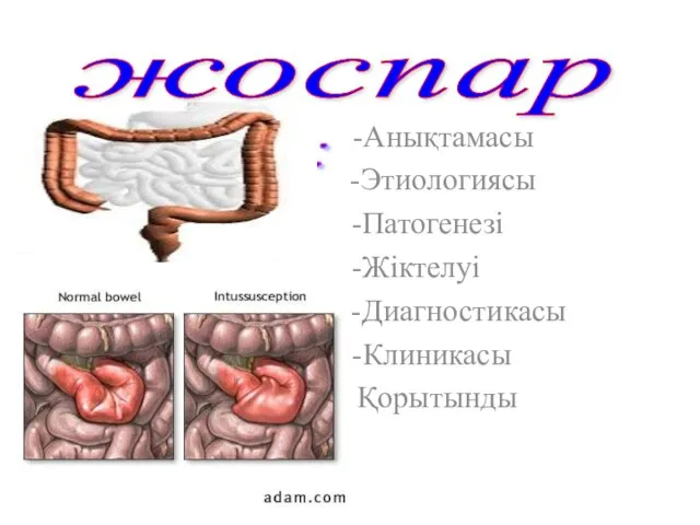 -Анықтамасы -Этиологиясы -Патогенезі -Жіктелуі -Диагностикасы -Клиникасы -Емі Қорытынды жоспар Жоспары: