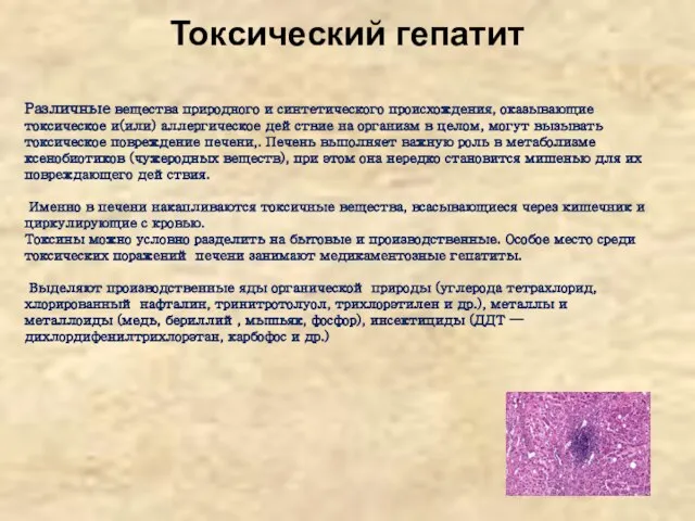 Токсический гепатит Различные вещества природного и синтетического происхождения, оказывающие токсическое и(или)