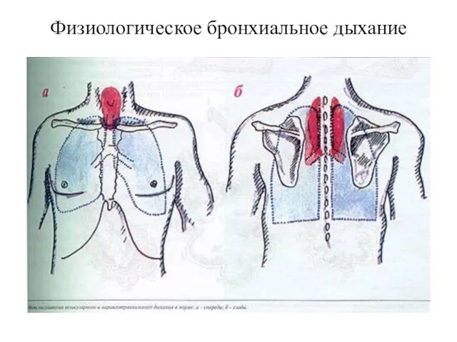 Физиологическое бронхиальное дыхание