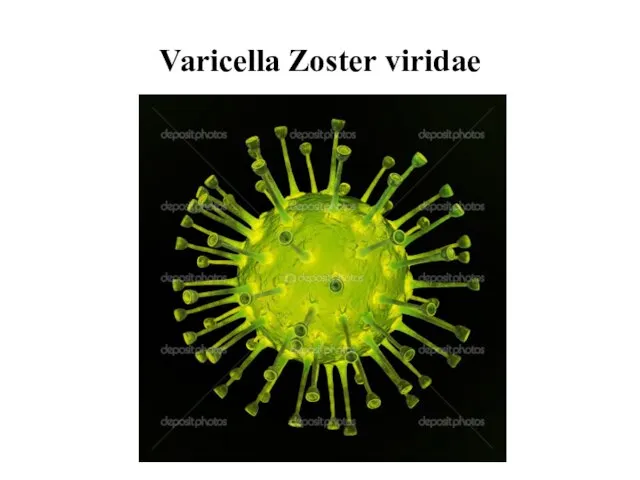 Varicella Zoster viridae