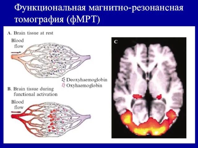 Функциональная магнитно-резонансная томография (фМРТ)