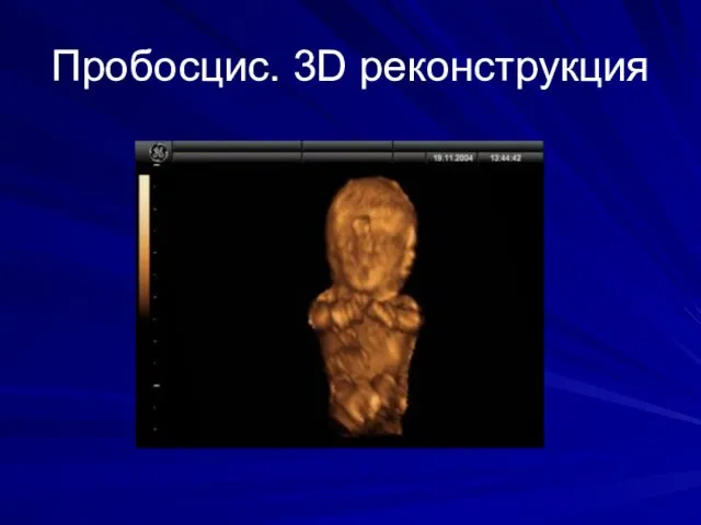 Пробосцис. 3D реконструкция