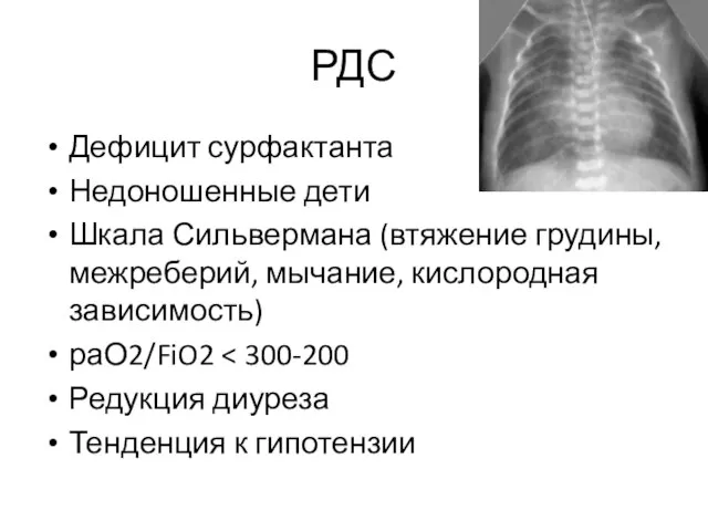 РДС Дефицит сурфактанта Недоношенные дети Шкала Сильвермана (втяжение грудины, межреберий, мычание,