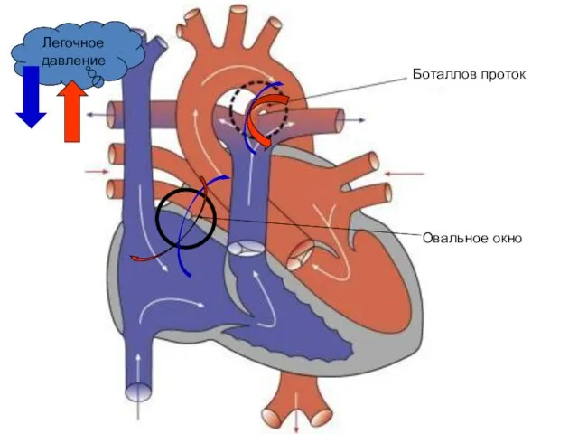 Боталлов проток Овальное окно Легочное давление