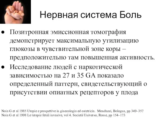 Нервная система Боль Позитронная эмиссионная томография демонстрирует максимальную утилизацию глюкозы в