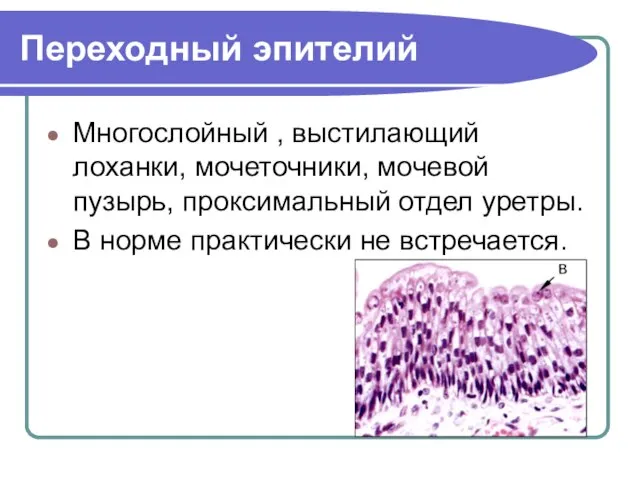 Переходный эпителий Многослойный , выстилающий лоханки, мочеточники, мочевой пузырь, проксимальный отдел