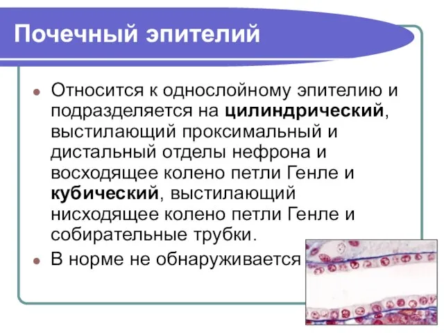 Почечный эпителий Относится к однослойному эпителию и подразделяется на цилиндрический, выстилающий