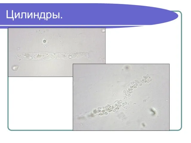 Цилиндры.