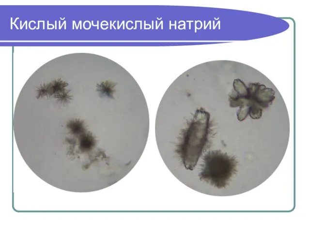 Кислый мочекислый натрий