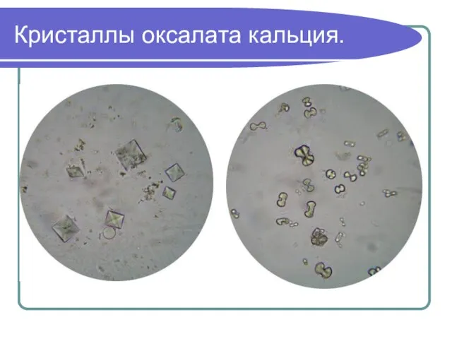 Кристаллы оксалата кальция.