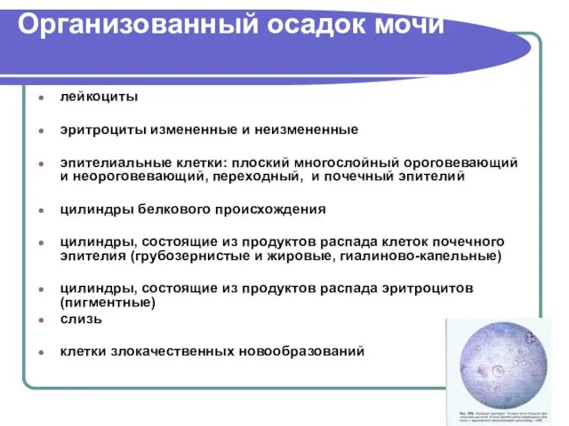 Организованный осадок мочи лейкоциты эритроциты измененные и неизмененные эпителиальные клетки: плоский