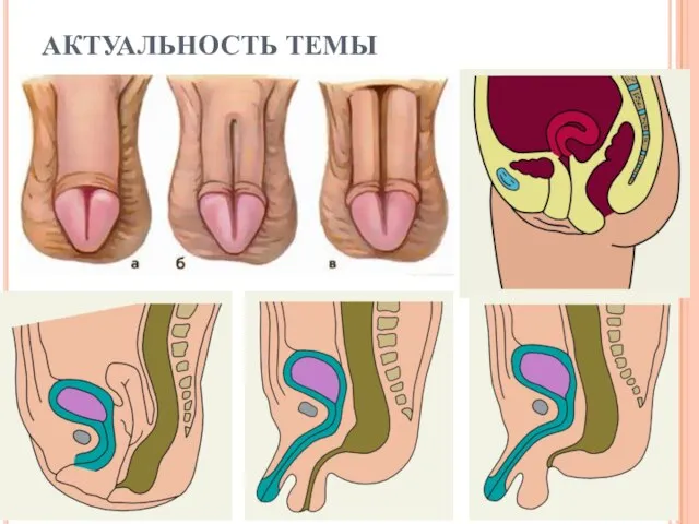 АКТУАЛЬНОСТЬ ТЕМЫ