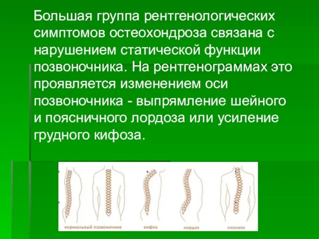 Большая группа рентгенологических симптомов остеохондроза связана с нарушением статической функции позвоночника.