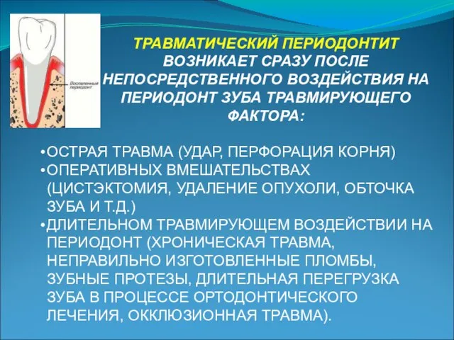 ТРАВМАТИЧЕСКИЙ ПЕРИОДОНТИТ ВОЗНИКАЕТ СРАЗУ ПОСЛЕ НЕПОСРЕДСТВЕННОГО ВОЗДЕЙСТВИЯ НА ПЕРИОДОНТ ЗУБА ТРАВМИРУЮЩЕГО