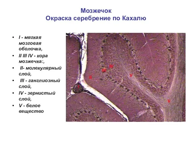 Мозжечок Окраска серебрение по Кахалю I - мягкая мозговая оболочка, II