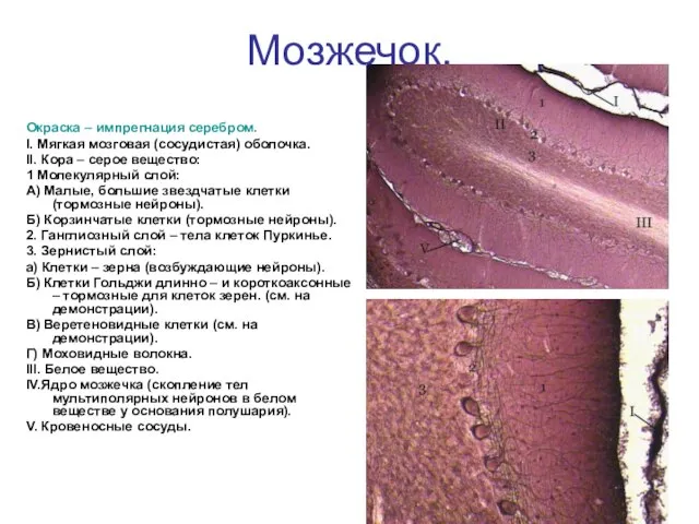 Мозжечок. Окраска – импрегнация серебром. I. Мягкая мозговая (сосудистая) оболочка. II.