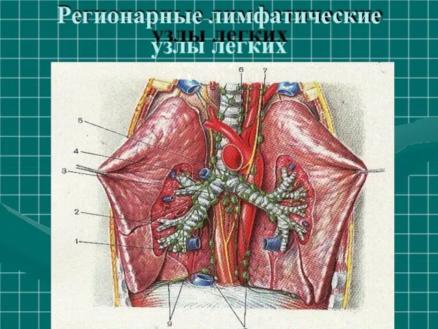 Регионарные лимфатические узлы легких