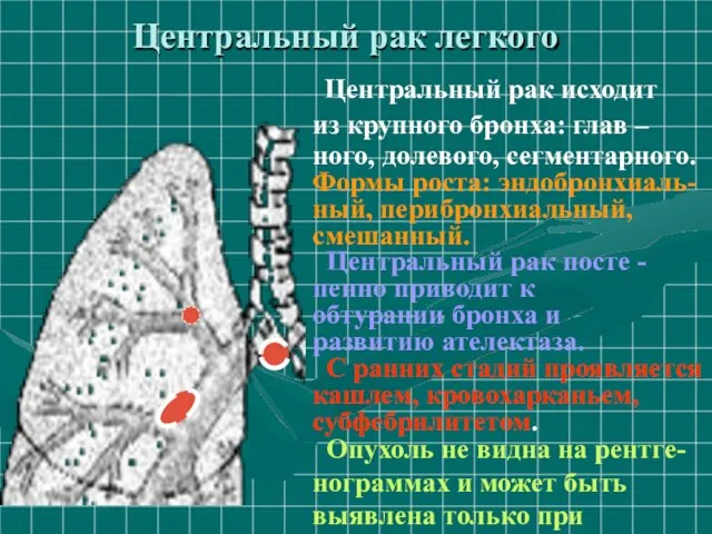 Центральный рак легкого Центральный рак исходит из крупного бронха: глав –