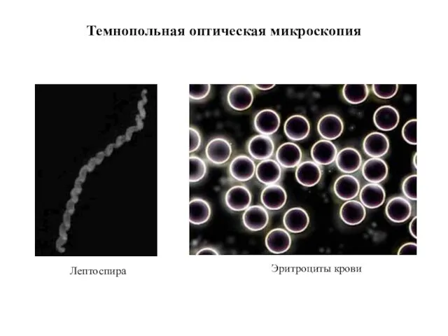 Темнопольная оптическая микроскопия Лептоспира Эритроциты крови