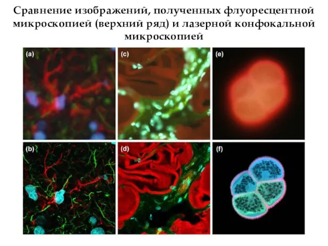 Сравнение изображений, полученных флуоресцентной микроскопией (верхний ряд) и лазерной конфокальной микроскопией