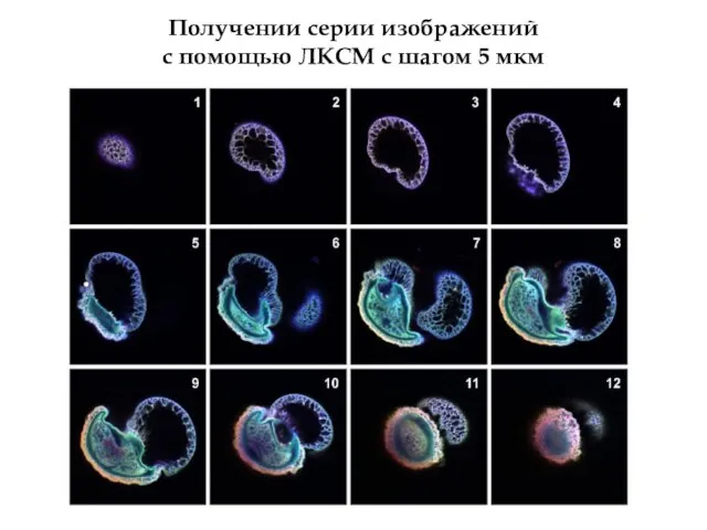 Получении серии изображений с помощью ЛКСМ с шагом 5 мкм